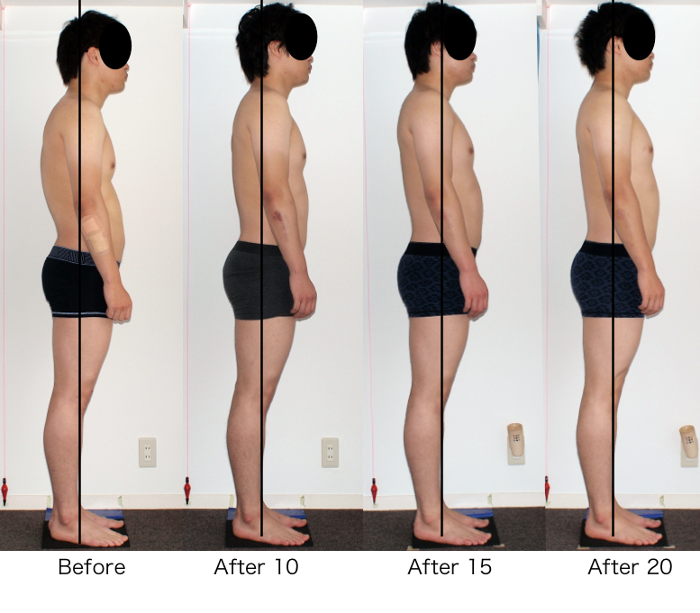 ロルフィング10回プラス10回