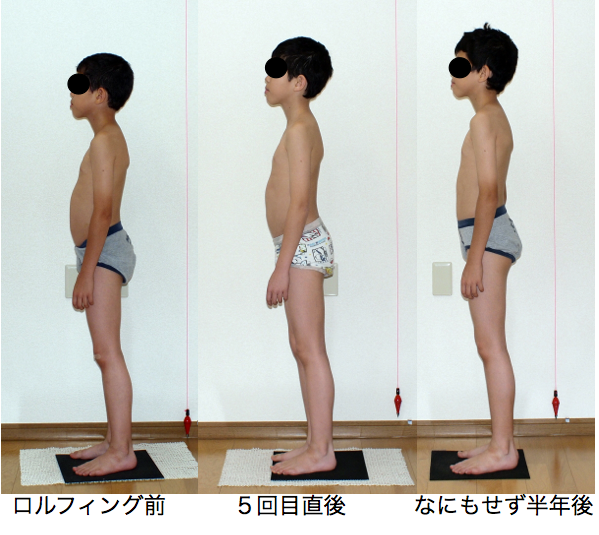 子供へのロルフィング継続効果